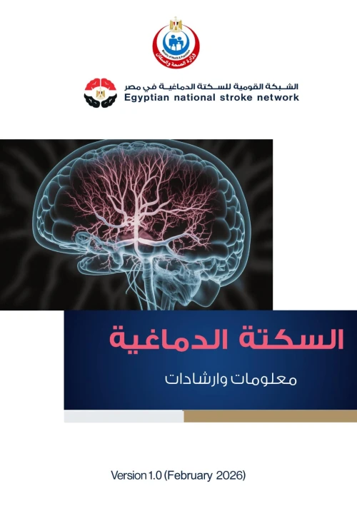 السكتة الدماغية (معلومات وارشادات)